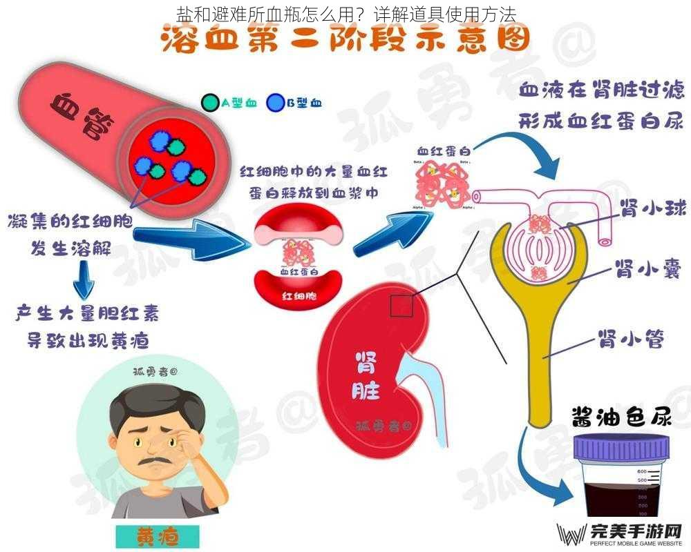 盐和避难所血瓶怎么用？详解道具使用方法